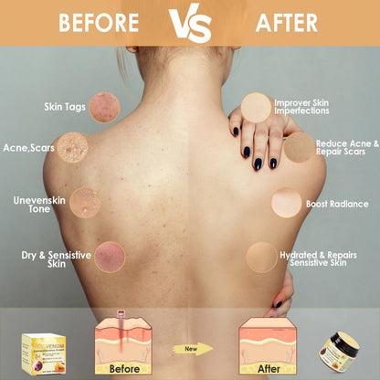 HoneyBee™ Bee Venom Skin Restoration Cream