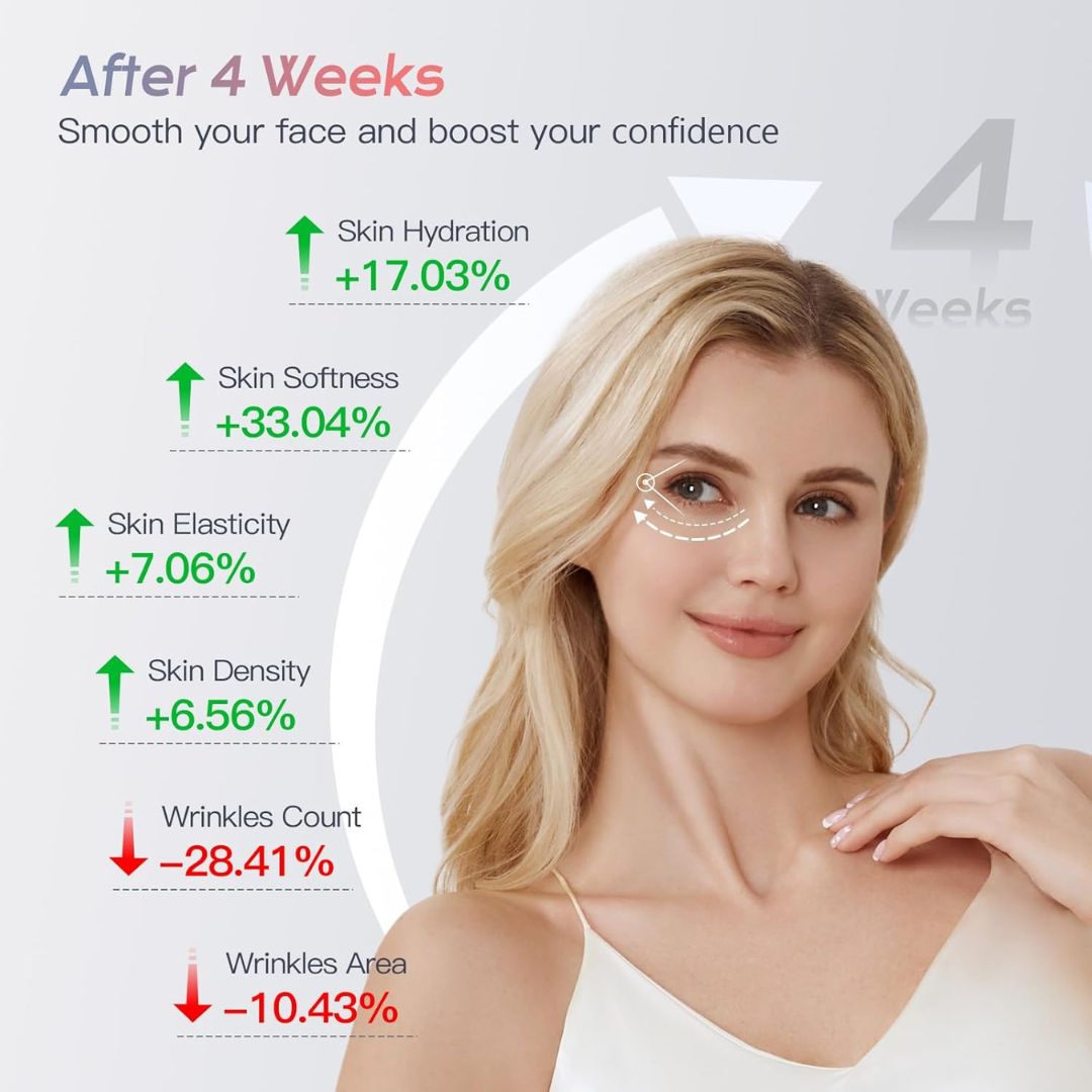 RFLift™ Skin Tightening Device