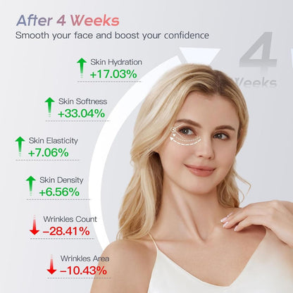 RFLift™ Skin Tightening Device