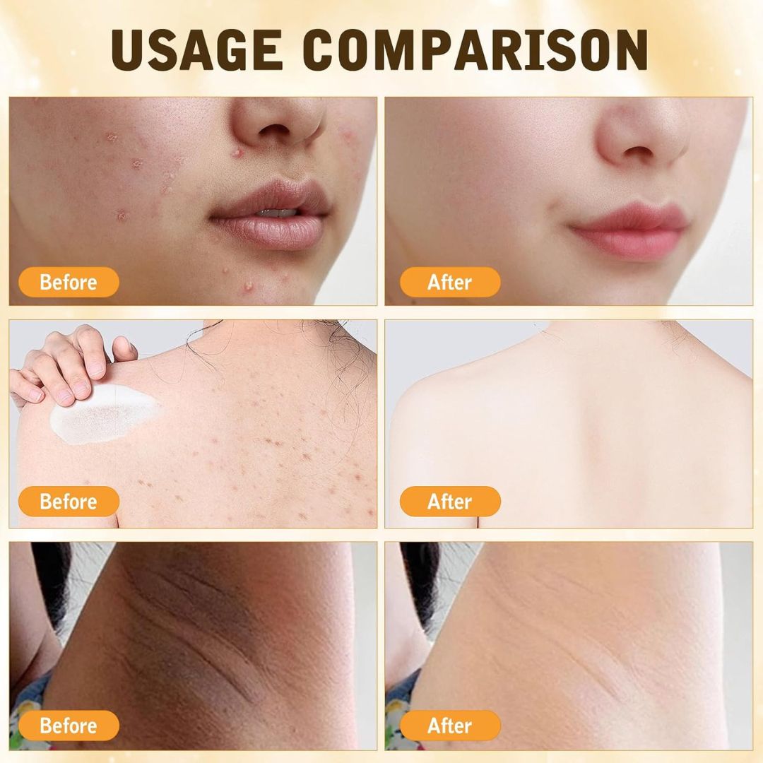 HoneyBee™ Bee Venom Skin Restoration Cream
